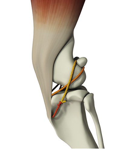 Kreuzbandriss Hund Bandersatzmethode kleine Hunde